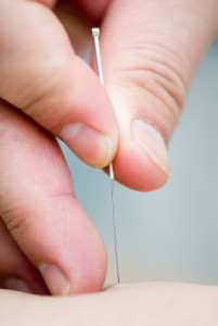Acupuncture Therapy Adelaide